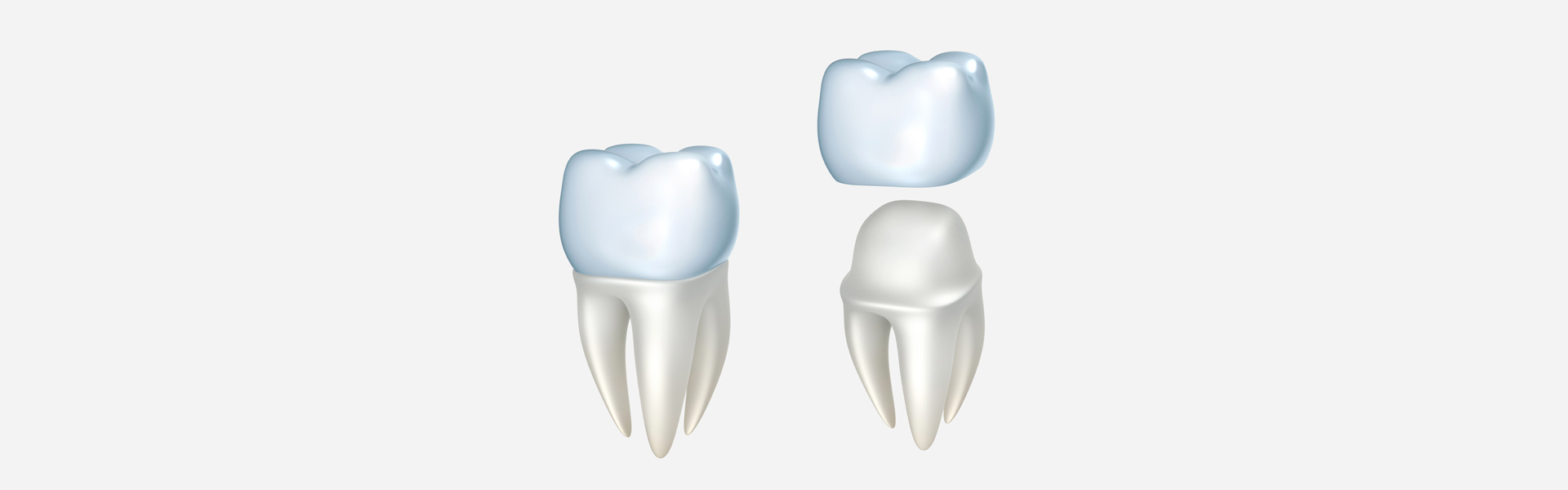 WHO NEEDS DENTAL CROWNS.
