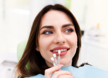 What are Veneers?