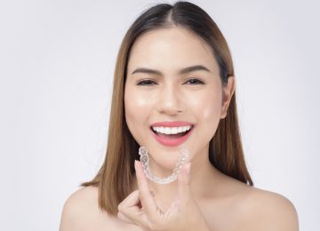 Everything You Need to Know About Invisalign