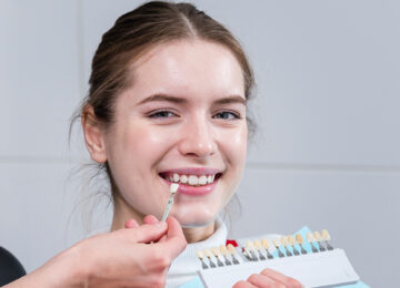 The Process of Getting Dental Veneers: What to Expect