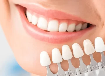 What Are Porcelain Veneers and How Can They Transform Your Smile?