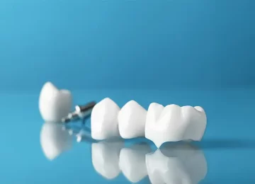 Is Your Dental Crown Failing? Key Signs It May Be Time for a Replacement